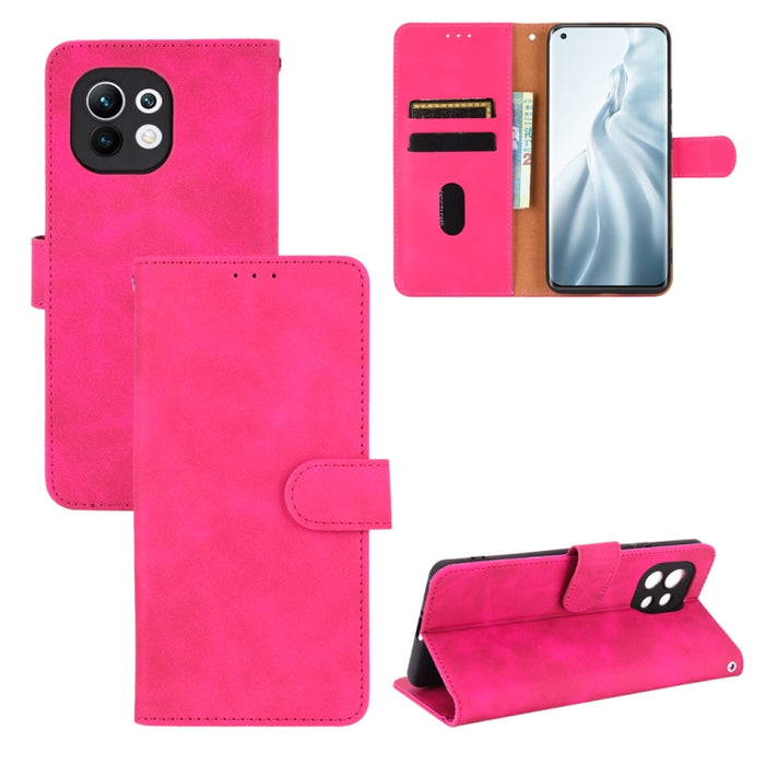 Funda de piel sintética con textura de piel de becerro con tapa horizontal y hebilla magnética con soporte, ranuras para tarjetas y cartera, For vivo X60 5G, For Nokia 5.4, For Xiaomi Mi 11, For UMIDIGI A7S