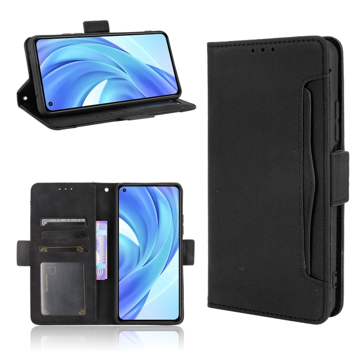 Estuche de cuero con tapa horizontal con patrón de piel de becerro con soporte y ranuras para tarjetas y marco de fotos, For Xiaomi Redmi Note 10 4G / Note 10S, For Xiaomi Redmi Note 10 Pro / Note 10 Pro Max, For Ulefone Note 11P                       ...