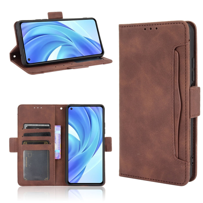 Estuche de cuero con tapa horizontal con patrón de piel de becerro con soporte y ranuras para tarjetas y marco de fotos, For Xiaomi Redmi Note 10 4G / Note 10S, For Xiaomi Redmi Note 10 Pro / Note 10 Pro Max, For Ulefone Note 11P                       ...