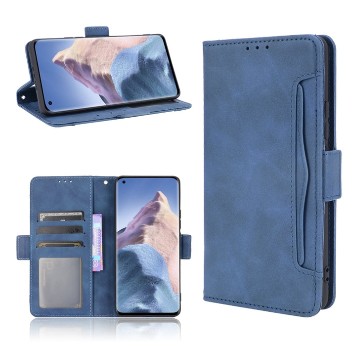 Estuche de cuero con tapa horizontal con patrón de piel de becerro con soporte y ranuras para tarjetas y marco de fotos, For Xiaomi Redmi Note 10 4G / Note 10S, For Xiaomi Redmi Note 10 Pro / Note 10 Pro Max, For Ulefone Note 11P                       ...