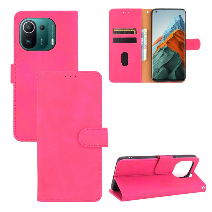 Funda de piel sintética con textura de piel de becerro con tapa horizontal y hebilla magnética con soporte, ranuras para tarjetas y cartera, For OPPO Realme C21, For Blackview BV6300 Pro, For Ulefone Note 11P, For Sony Xperia 1 III, For Xiaomi Mi 11 Ul...