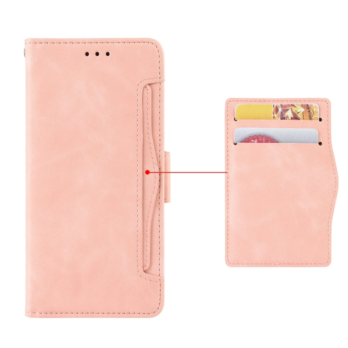 Estuche de cuero con tapa horizontal con patrón de piel de becerro con soporte y ranuras para tarjetas y marco de fotos, For Blackview A90, For Umidigi A11
