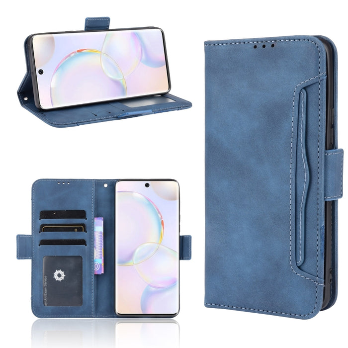 Estuche de cuero con tapa horizontal con patrón de piel de becerro con soporte y ranuras para tarjetas y marco de fotos, For Motorola Moto G50 5G Oversea Version, For OPPO Realme 8i, For vivo Y33S / Y21 / Y21S, For Nokia G50 5G                         ...
