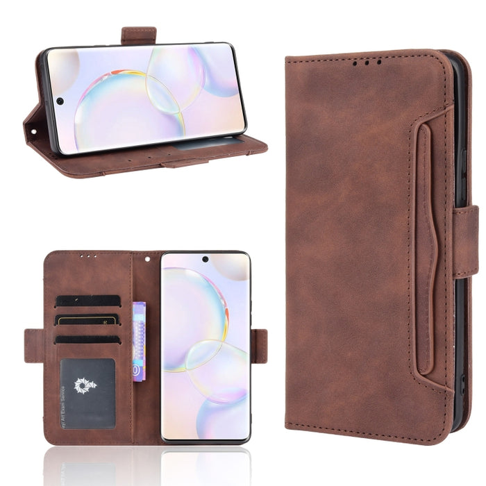 Estuche de cuero con tapa horizontal con patrón de piel de becerro con soporte y ranuras para tarjetas y marco de fotos, For Motorola Moto G50 5G Oversea Version, For OPPO Realme 8i, For vivo Y33S / Y21 / Y21S, For Nokia G50 5G                         ...