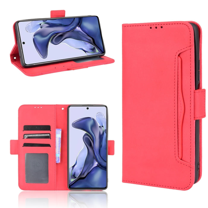 Estuche de cuero con tapa horizontal con patrón de piel de becerro con soporte y ranuras para tarjetas y marco de fotos, For Motorola Moto G50 5G Oversea Version, For OPPO Realme 8i, For vivo Y33S / Y21 / Y21S, For Nokia G50 5G                         ...