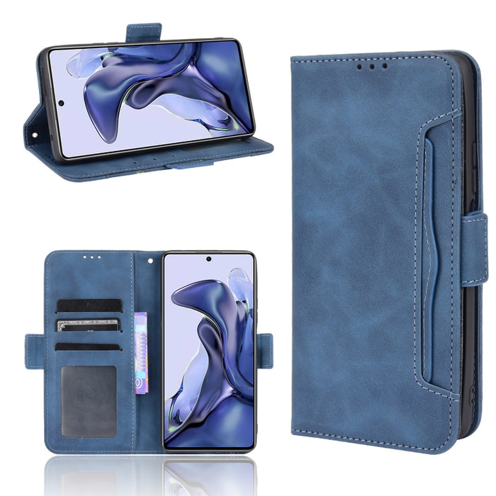 Estuche de cuero con tapa horizontal con patrón de piel de becerro con soporte y ranuras para tarjetas y marco de fotos, For Motorola Moto G50 5G Oversea Version, For OPPO Realme 8i, For vivo Y33S / Y21 / Y21S, For Nokia G50 5G                         ...