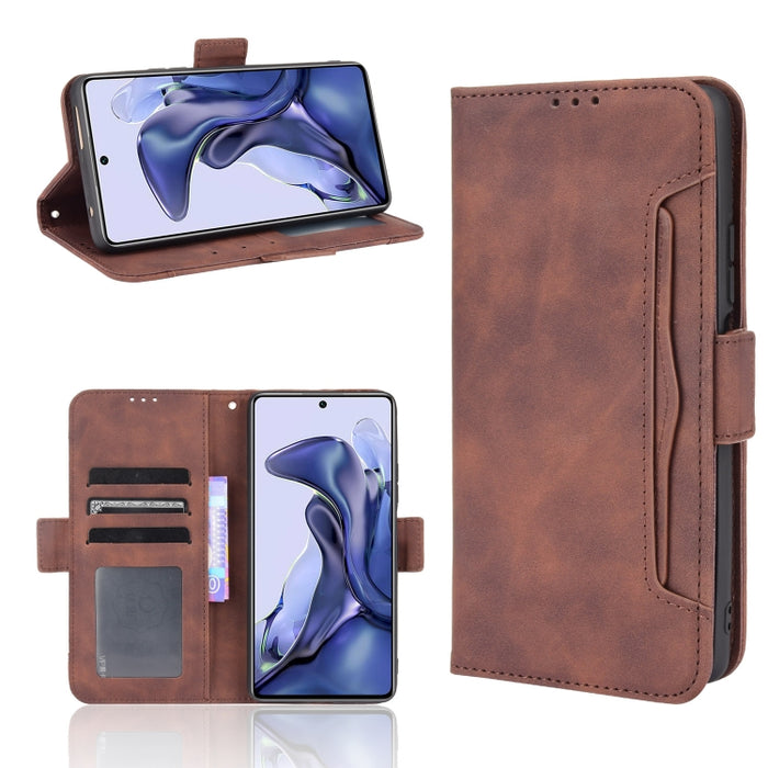 Estuche de cuero con tapa horizontal con patrón de piel de becerro con soporte y ranuras para tarjetas y marco de fotos, For Motorola Moto G50 5G Oversea Version, For OPPO Realme 8i, For vivo Y33S / Y21 / Y21S, For Nokia G50 5G                         ...