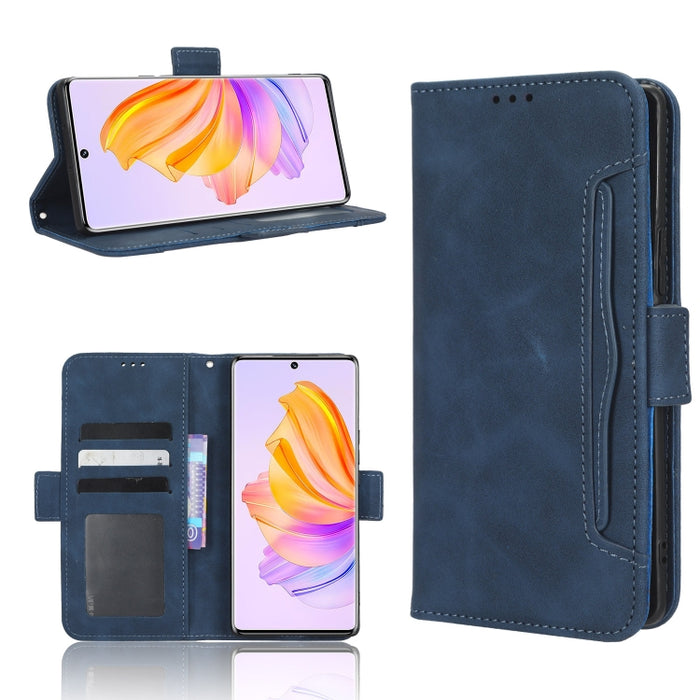 Funda de piel para teléfono con textura de piel de becerro y ranuras para tarjetas, For Cricket Debut Smart, For Cricket Icon 4, For Cricket Innovate E 5G, For OPPO A1 Pro, For Realme 10 4G, For Realme 10 Pro, For TCL ION Z, For Tecno Pop 6 BE7        ...