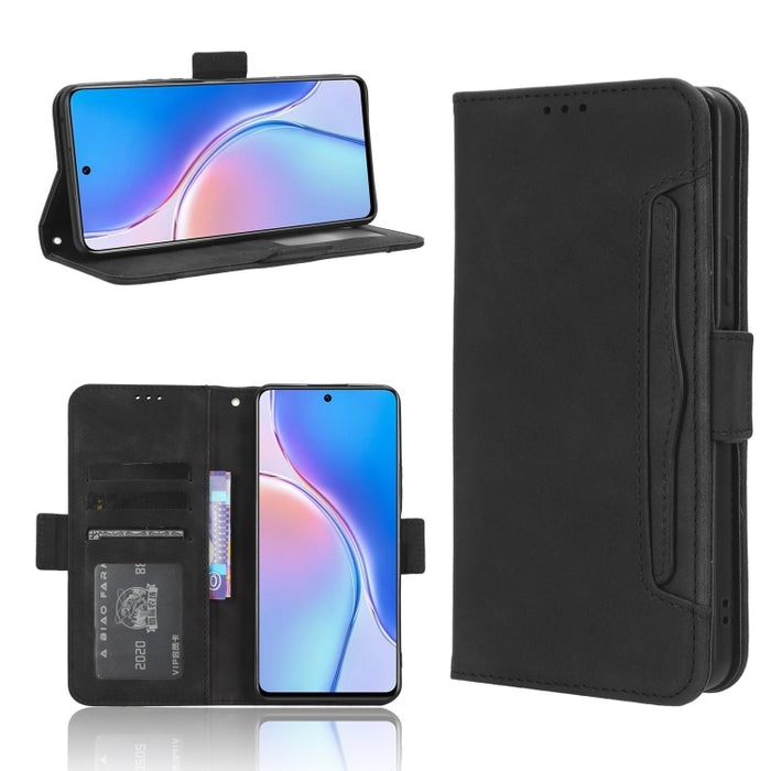 Funda de piel para teléfono con textura de piel de becerro y ranuras para tarjetas, For Huawei P60 Art, For Huawei P60 / P60 Pro, For Huawei Enjoy 60 4G, For Huawei Maimang 20, For Blackview A85, For Nokia C22, For Nokia C32 4G, For Nokia C12          ...