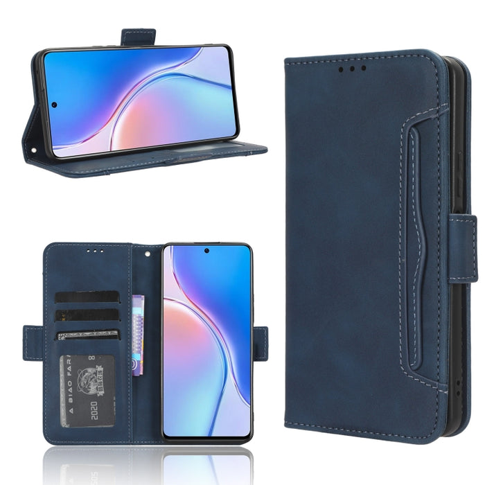 Funda de piel para teléfono con textura de piel de becerro y ranuras para tarjetas, For Huawei P60 Art, For Huawei P60 / P60 Pro, For Huawei Enjoy 60 4G, For Huawei Maimang 20, For Blackview A85, For Nokia C22, For Nokia C32 4G, For Nokia C12          ...