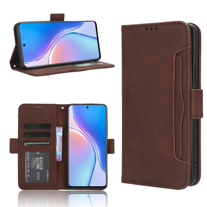 Funda de piel para teléfono con textura de piel de becerro y ranuras para tarjetas, For Huawei P60 Art, For Huawei P60 / P60 Pro, For Huawei Enjoy 60 4G, For Huawei Maimang 20, For Blackview A85, For Nokia C22, For Nokia C32 4G, For Nokia C12          ...