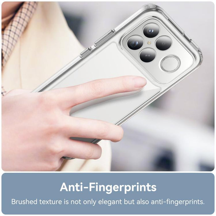 Funda para teléfono de TPU acrílico con botones galvanizados WANLONFENG y protector de pantalla, For Redmi K90 Pro Max / Poco F8 Ultra, For Redmi K90 / Poco F8 Pro, For Redmi 15 5G / 4G EU 171mm, For Redmi 15C 5G / 4G EU 173mm                          ...