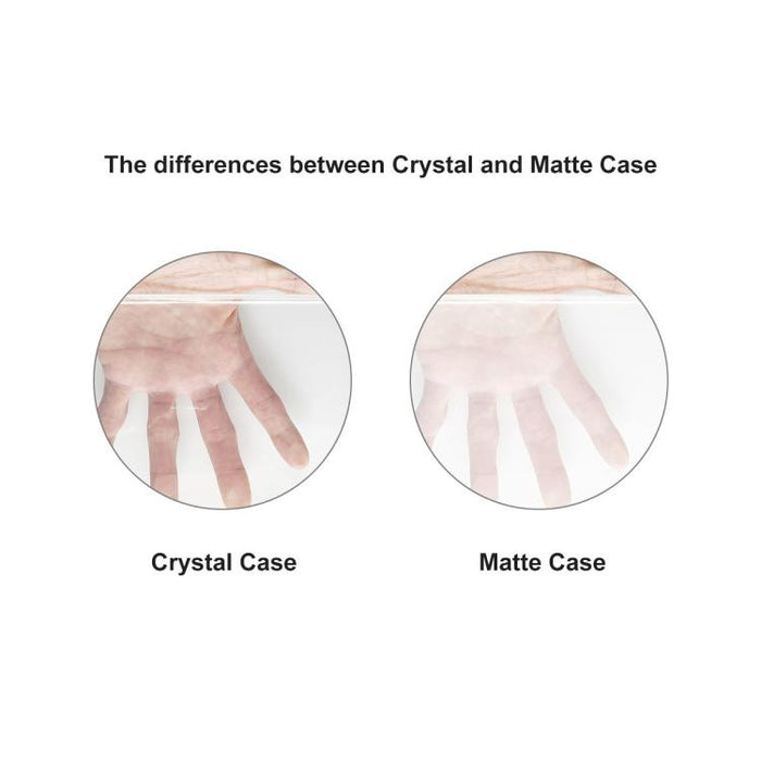 Funda protectora ENKAY versión estadounidense 3 en 1 Crystal con protector de pantalla de TPU y protector de pantalla de PET., For MacBook Neo 13 inch 2026 (A3404) 256G, For MacBook Neo 13 inch 2026 (A3404) 512G